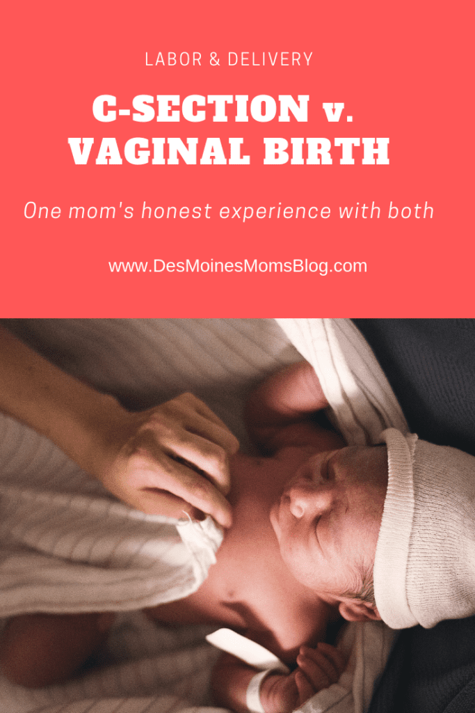 c-section or vaginal birth