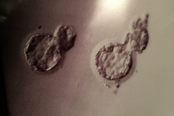 twin embryos infertility awareness des moines moms blog