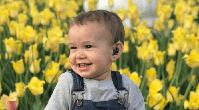 toddler sitting in front of yellow tulips with hearing aid. child deaf